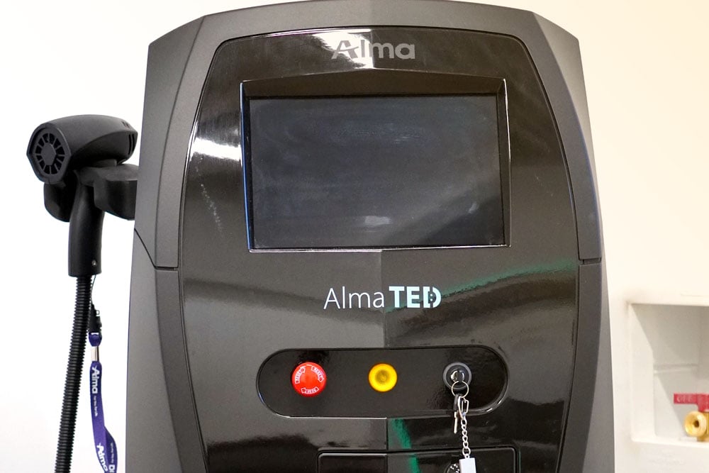 Alma-TED