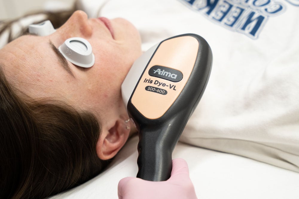 laser-treatment-featured-1