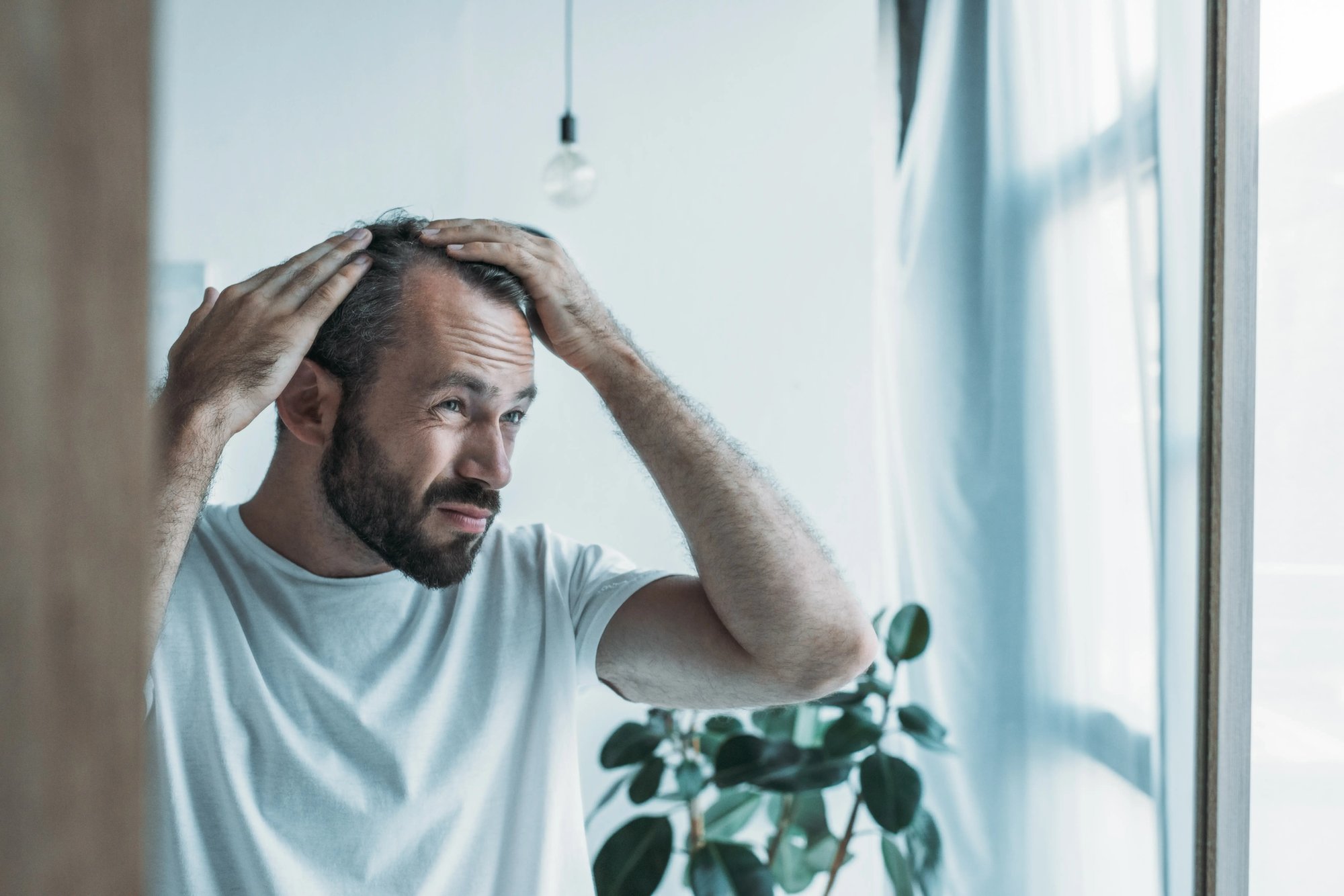 hairloss_alopecia_upset-middle-aged-man-looking-at-mirror
