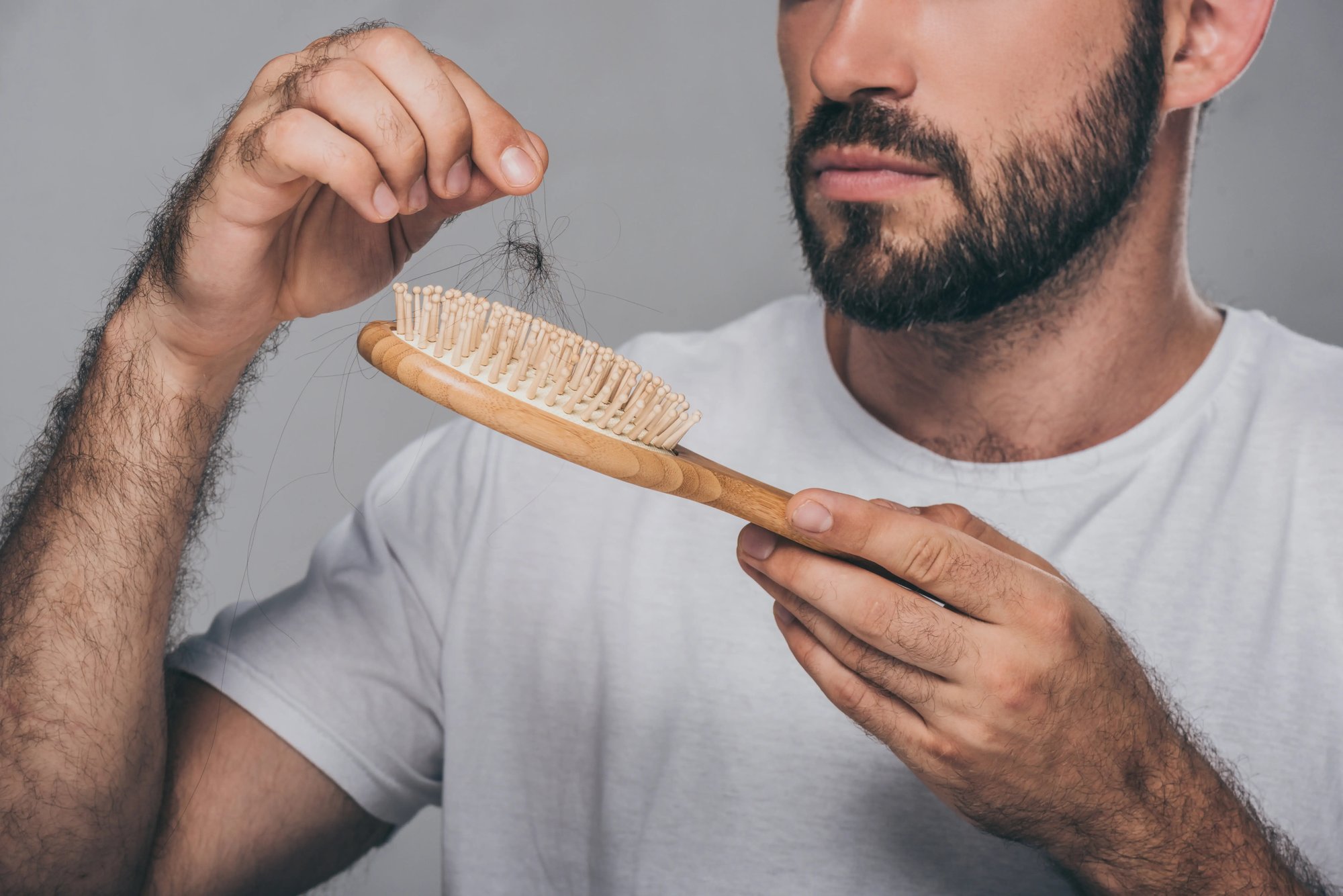 hairloss_bearded-man-holding-hairbrush