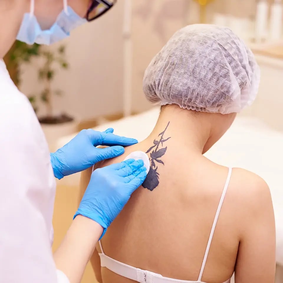 laser-tattoo-removal_cosmetology-clinic_960px