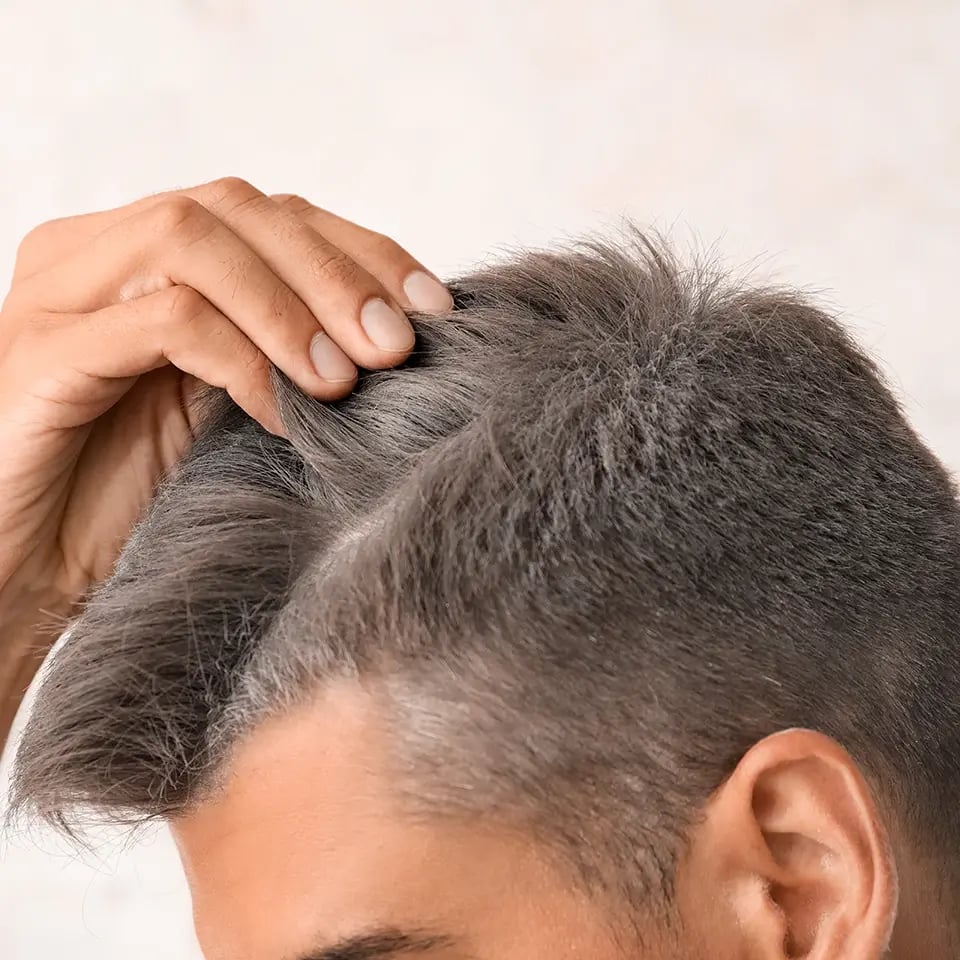 scalp-health_man-graying-hair-closeup_960px