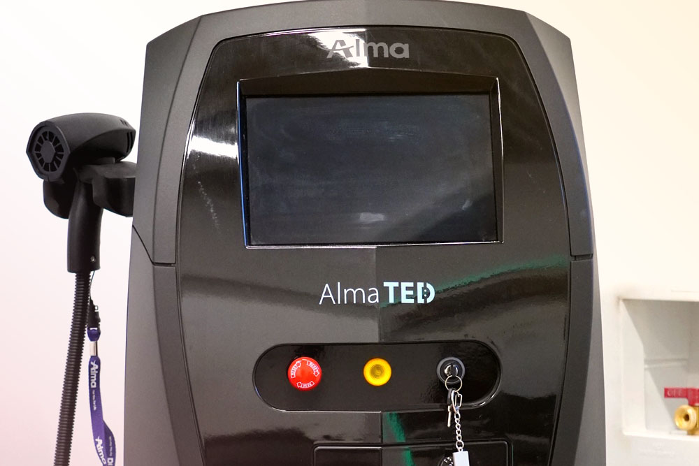 Alma-TED-1
