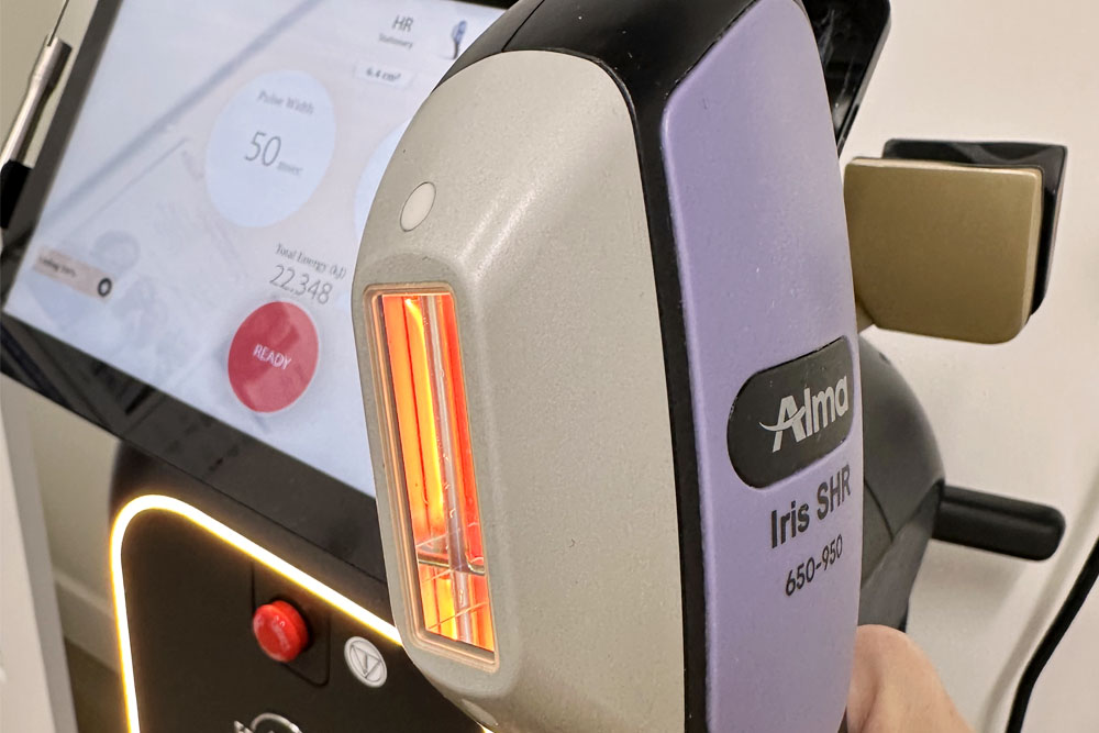 Laser-Treatment_Alma-Iris-Super-Hair-Removal-1