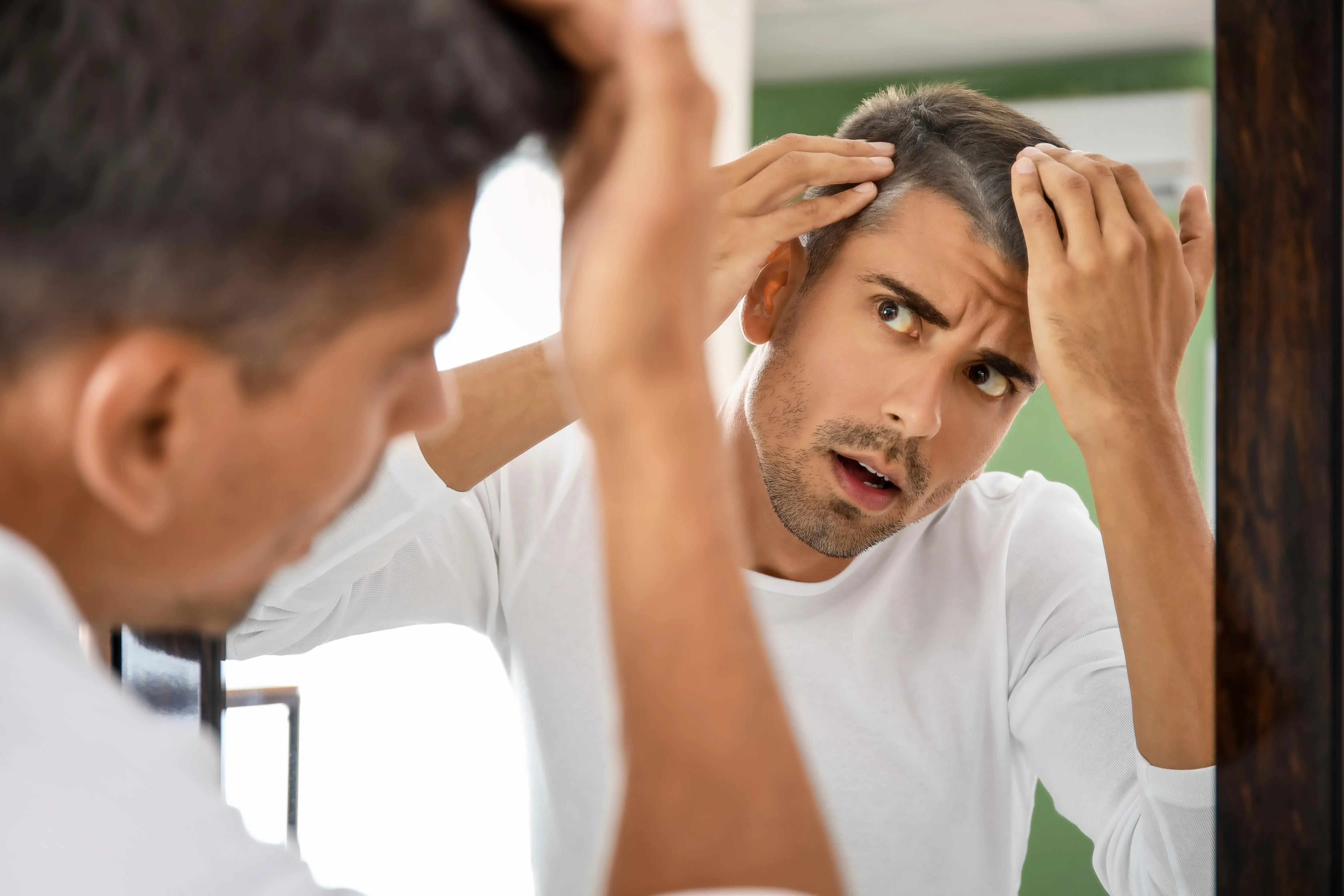 hairloss_stressed-man-checking-hair-mirror